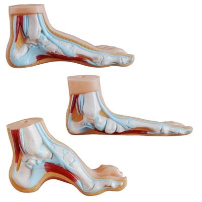 Anatomisk modell fot med 3 fötter normal, bågfot och plattfot