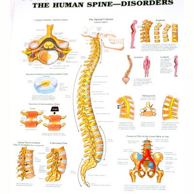 The Human Spine-Disorders