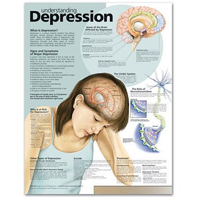 Understanding Depression Anatomical  - att förstå depression affisch 50x65cm laminerad