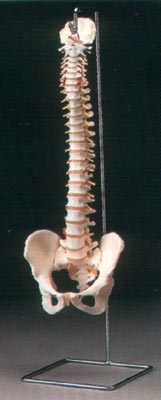 Anatomisk modell ryggrad med bäcken inklusive diskbråck på stativ
